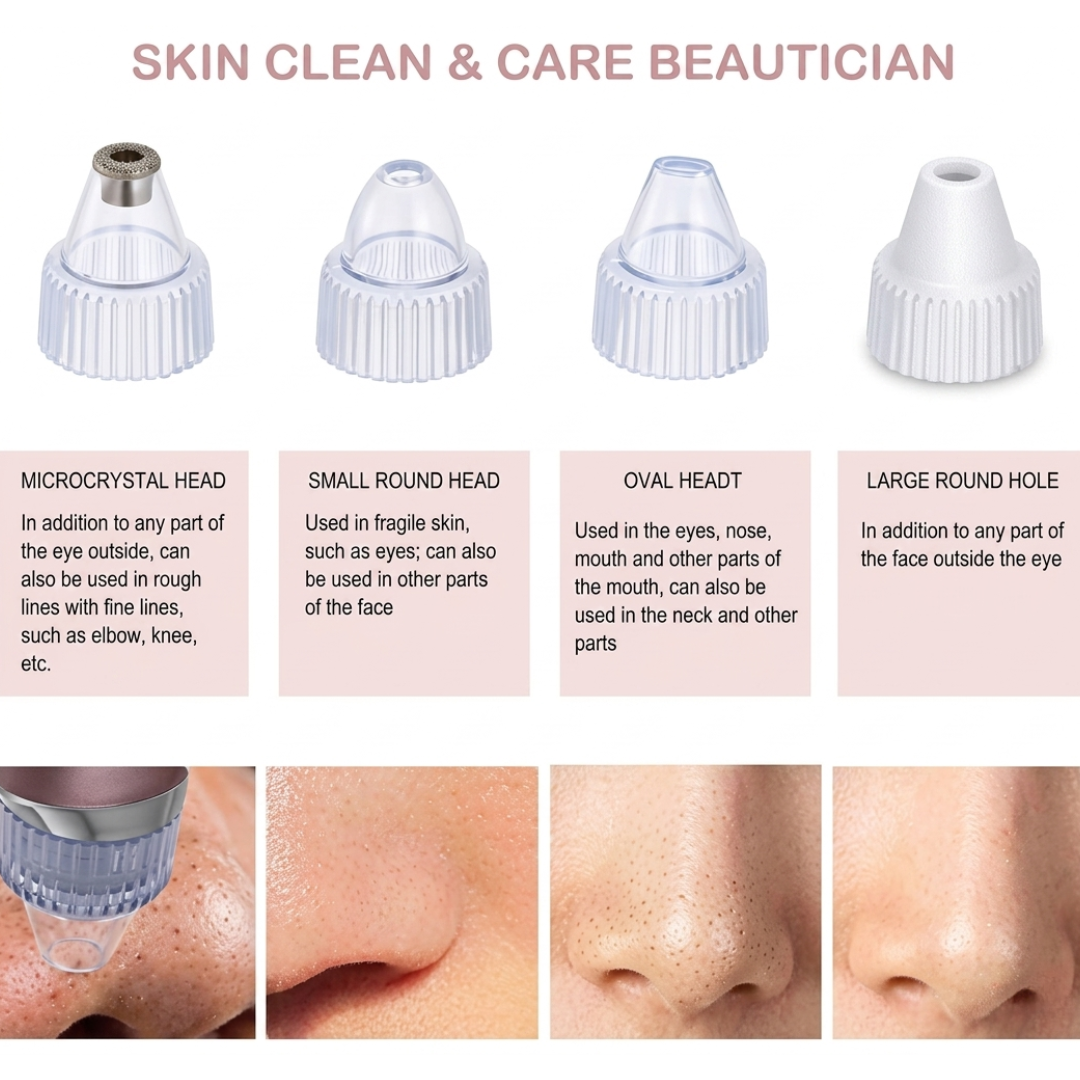 DermaSuction™ Pore Vacuum Blackhead Extractor