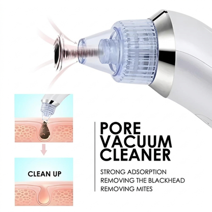 DermaSuction™ Pore Vacuum Blackhead Extractor